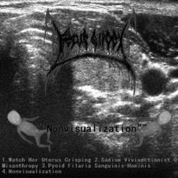 Fetus Slicer : Nonvisualization